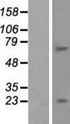Western Blot: BTBD11 Overexpression Lysate (Adult Normal) [NBP2-05405] Left-Empty vector transfected control cell lysate (HEK293 cell lysate); Right -Over-expression Lysate for BTBD11.