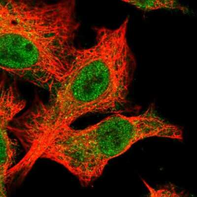 Immunocytochemistry/Immunofluorescence: BTBD12 Antibody [NBP2-58436] - Staining of human cell line A549 shows localization to nucleoplasm & cytosol.