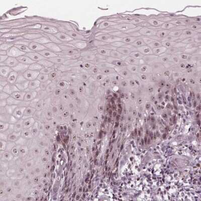 Immunohistochemistry: BTBD12 Antibody [NBP2-39070] - Staining of human cervix, uterine shows moderate nucleolar positivity in squamous epithelial cells.