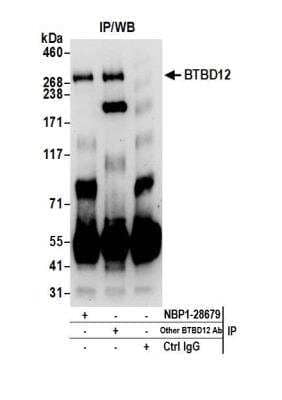 Immunoprecipitation: BTBD12 Antibody [NBP1-28679] - Detection of human BTBD12 by western blot of immunoprecipitates. Samples: Whole cell lysate (0.5 or 1.0 mg per IP reaction; 20% of IP loaded) from HeLa cells prepared using NETN lysis buffer. Antibodies: Affinity purified rabbit anti-BTBD12 antibody NBP1-28679 used for IP at 6 ug per reaction. BTBD12 was also immunoprecipitated by another rabbit anti-BTBD12 antibody. For blotting immunoprecipitated BTBD12, NBP1-28679 was used at 3 ug/ml. Detection: Chemiluminescence with an exposure time of 30 seconds.