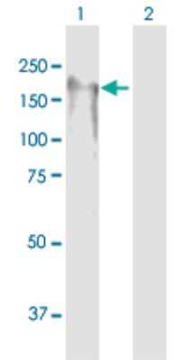 Western Blot: BTBD12 Antibody [H00084464-B01P] - Analysis of BTBD12 expression in transfected 293T cell line by BTBD12 polyclonal antibody.  Lane 1: BTBD12 transfected lysate(126.61 KDa). Lane 2: Non-transfected lysate.