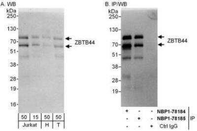 Western Blot: BTBD15 Antibody [NBP1-78184] - Whole cell lysate from Jurkat (15 and 50 mcg for WB; 1 mg for IP, 20% of IP loaded), HeLa (H; 50 mcg) and 293T (T; 50 mcg) cells.   Affinity purified rabbit anti-ZBTB44 antibody used for WB at 0.1 mcg/ml (A) and 1 mcg/ml (B) and used for IP at 6 mcg/mg lysate.  ZBTB44 was also immunoprecipitated by rabbit anti-ZBTB44 antibody NBP1-78185, which recognizes a downstream epitope.