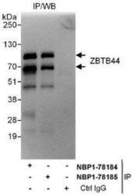Western Blot: BTBD15 Antibody [NBP1-78185] - Whole cell lysate (1 mg for IP, 20% of IP loaded) from Jurkat cells. Affinity purified rabbit anti-ZBTB44 antibody  used for IP at 6 mcg/mg lysate.  ZBTB44 was also immunoprecipitated by rabbit anti-ZBTB44 antibody NBP1-78184, which recognizes an upstream epitope.
