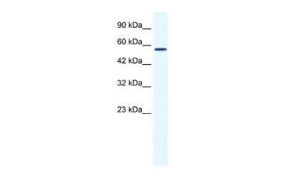 Western Blot: BTBD15 Antibody [NBP2-87089] - WB Suggested Anti-BTBD15 Antibody Titration: 0.2-1 ug/ml. ELISA Titer: 1:62500. Positive Control: HepG2 cell lysate