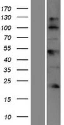 Western Blot: BTBD17 Overexpression Lysate (Adult Normal) [NBP2-08336] Left-Empty vector transfected control cell lysate (HEK293 cell lysate); Right -Over-expression Lysate for BTBD17.