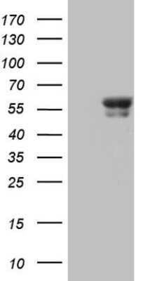 Western Blot: BTBD3 Antibody (OTI1A10) - Azide and BSA Free [NBP2-71699] - Analysis of HEK293T cells were transfected with the pCMV6-ENTRY control (Left lane) or pCMV6-ENTRY BTBD3.
