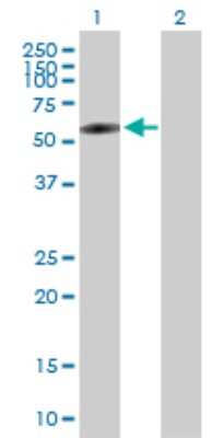 Western Blot: BTBD3 Antibody [H00022903-B01P] - Analysis of BTBD3 expression in transfected 293T cell line by BTBD3 polyclonal antibody.  Lane 1: BTBD3 transfected lysate(57.42 KDa). Lane 2: Non-transfected lysate.