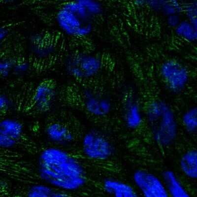Immunocytochemistry/Immunofluorescence: BTBD7 Antibody [NBP2-14364] - Staining of human cell line RT4 shows localization to focal adhesion sites. Antibody staining shown in green. 