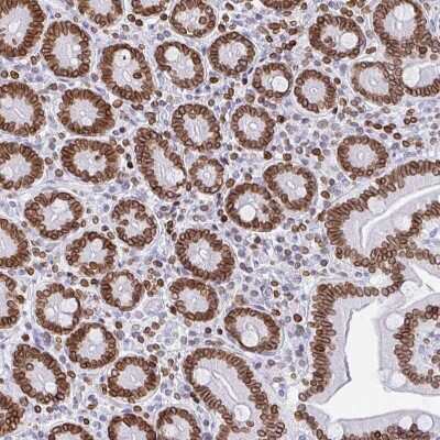 Immunohistochemistry: BTBD7 Antibody [NBP2-38699] - Staining of human duodenum shows strong nuclear membranous  positivity in glandular cells.
