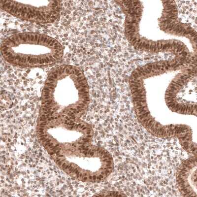 Immunohistochemistry-Paraffin: BTBD7 Antibody [NBP2-14364] - Staining of human endometrium shows moderate nuclear positivity in glandular cells, as well as weaker staining in stromal cells.