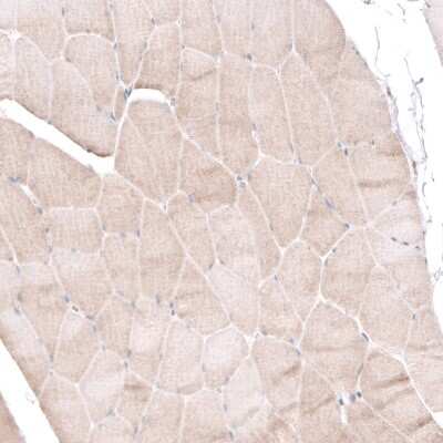 Immunohistochemistry-Paraffin: BTBD7 Antibody [NBP2-14364] - Staining of human skeletal muscle shows no nuclear positivity in striated muscle fibers as expected.