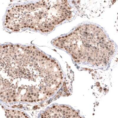 Immunohistochemistry-Paraffin: BTBD7 Antibody [NBP2-14364] - Staining of human testis shows moderate to strong nuclear positivity in cells in seminiferous ducts.