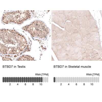 Immunohistochemistry-Paraffin: BTBD7 Antibody [NBP2-14364] - Staining in human testis and skeletal muscle tissues . Corresponding BTBD7 RNA-seq data are presented for the same tissues.