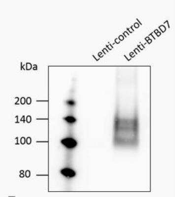 Western Blot: BTBD7 Antibody [NBP1-49652] - Human 293T cells were infected by lentivirus overexpression of control or BTBD7 for 72h. Total cell lysates were subjected to Western blot. PVDF membrane was probed with BTBD7 Antibody. A specific band was detected for BTBD7 at  approximately 138 kDa. Image from verified customer review.