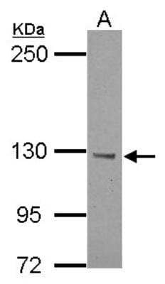Western Blot: BTBD7 Antibody [NBP2-15628] - A: U87-MG. Sample (30 ug of whole cell lysate). 5% SDS PAGE. Diluted at 1:1000 