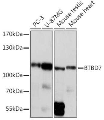Western Blot: BTBD7 Antibody [NBP2-92399] - Western blot analysis of extracts of various cell lines, using BTBD7 antibody at 1:1000 dilution. Secondary antibody: HRP Goat Anti-Rabbit IgG (H+L) at 1:10000 dilution. Lysates/proteins: 25ug per lane. Blocking buffer: 3% nonfat dry milk in TBST. Detection: ECL Basic Kit. Exposure time: 10s.