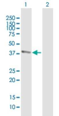 Western Blot: BTBD8 Antibody [H00284697-B01P] - Analysis of BTBD8 expression in transfected 293T cell line by BTBD8 polyclonal antibody.  Lane 1: BTBD8 transfected lysate(41.58 KDa). Lane 2: Non-transfected lysate.