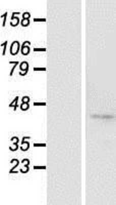 Western Blot: BTBD8 Overexpression Lysate (Adult Normal) [NBP2-04783] Left-Empty vector transfected control cell lysate (HEK293 cell lysate); Right -Over-expression Lysate for BTBD8.