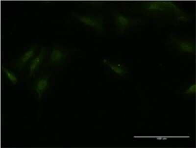 Immunocytochemistry/Immunofluorescence: BTBD9 Antibody (1G3) [H00114781-M02] - Analysis of monoclonal antibody to BTBD9 on HeLa cell . Antibody concentration 10 ug/ml.