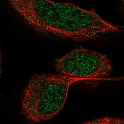 Immunocytochemistry/Immunofluorescence: BTBD9 Antibody [NBP1-84228] - Immunofluorescent staining of human cell line U-2 OS shows localization to nucleoplasm.