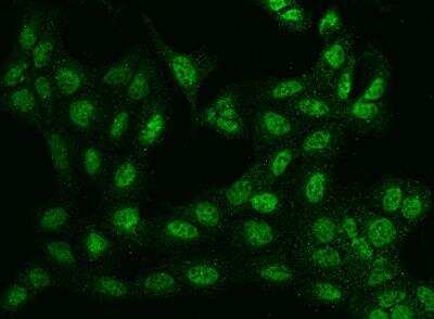 Immunocytochemistry/Immunofluorescence: BTBD9 Antibody [NBP3-05962] - Staining of BTBD9 in U2OS cells. Cells were fixed with 4% PFA, permeabilzed with 0.1% Triton X-100 in PBS,blocked with 10% serum, and incubated with rabbit anti-Human BTBD9 polyclonal antibody (dilution ratio 1:100) at 4? overnight. Then cells were stained with the Alexa Fluor®488-conjugated Goat Anti-rabbit IgG secondary antibody (green). Positive staining was localized to Nucleus.