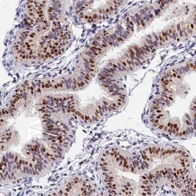 Immunohistochemistry-Paraffin: BTBD9 Antibody [NBP1-84228] - Staining of human fallopian tube shows strong nuclear positivity in glandular cells.