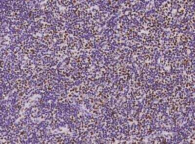 Immunohistochemistry-Paraffin: BTBD9 Antibody [NBP3-05962] -  Staining of human BTBD9 in human lymph node with rabbit polyclonal antibody at 1:1000 dilution.