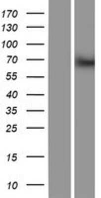 Western Blot: BTBD9 Overexpression Lysate (Adult Normal) [NBP2-05845] Left-Empty vector transfected control cell lysate (HEK293 cell lysate); Right -Over-expression Lysate for BTBD9.