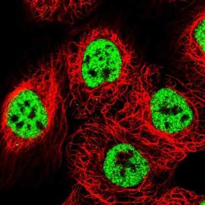 <b>Genetic Strategies Validation. </b>Immunocytochemistry/Immunofluorescence: BTF Antibody [NBP1-89924] - Staining of human cell line A-431 shows localization to nuclear speckles. Antibody staining is shown in green.