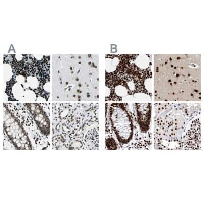 <b>Independent Antibodies Validation. </b>Immunohistochemistry-Paraffin: BTF Antibody [NBP1-89923] - Staining of human bone marrow, cerebral cortex, colon and kidney using Anti-BCLAF1 antibody NBP1-89923 (A) shows similar protein distribution across tissues to independent antibody NBP1-89924 (B).