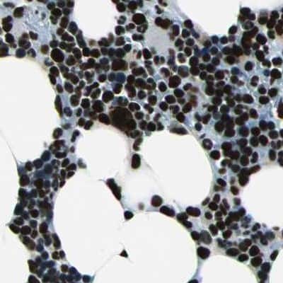 Immunohistochemistry-Paraffin: BTF Antibody [NBP1-89923] - Staining of human bone marrow.