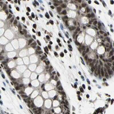 Immunohistochemistry-Paraffin: BTF Antibody [NBP1-89923] - Staining of human colon.
