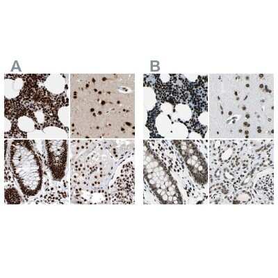<b>Independent Antibodies Validation. </b>Immunohistochemistry-Paraffin: BTF Antibody [NBP1-89924] - Staining of human bone marrow, cerebral cortex, colon and kidney using Anti-BCLAF1 antibody NBP1-89924 (A) shows similar protein distribution across tissues to independent antibody NBP1-89923 (B).