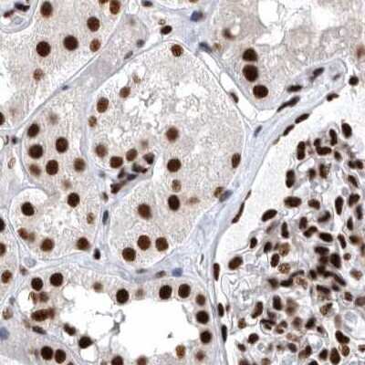 Immunohistochemistry-Paraffin: BTF Antibody [NBP1-89924] - Staining of human kidney.