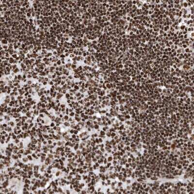 Immunohistochemistry-Paraffin: BTF Antibody [NBP1-89924] - Staining of human lymphoid tissues shows strong nuclear positivity in lymphocytes.