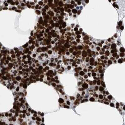 Immunohistochemistry-Paraffin: BTF Antibody [NBP1-89924] - Staining of human bone marrow.