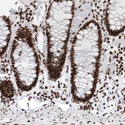 Immunohistochemistry-Paraffin: BTF Antibody [NBP1-89924] - Staining of human gastrointestinal shows strong nuclear positivity in glandular cells.