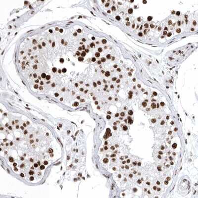 Immunohistochemistry-Paraffin: BTF Antibody [NBP1-89924] - Staining of human testis shows strong nuclear positivity in cells in seminiferous ducts.