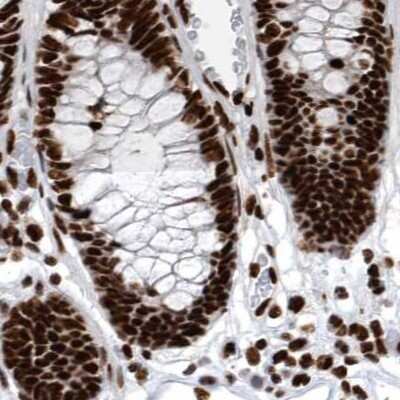Immunohistochemistry-Paraffin: BTF Antibody [NBP1-89924] - Staining of human colon.