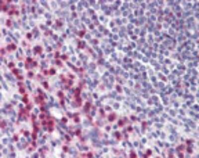 Immunohistochemistry-Paraffin: BTF Antibody [NBP2-24859] - analysis of human spleen probed with BTF antibody at 10 ug/ml.