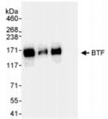 Immunoprecipitation: BTF Antibody [NB100-1704] - Whole cell lysate from HeLa (5, 15 and 50 ug for WB; 1 mg for IP, 20% of IP loaded) and 293T (T; 50 ug) cells.