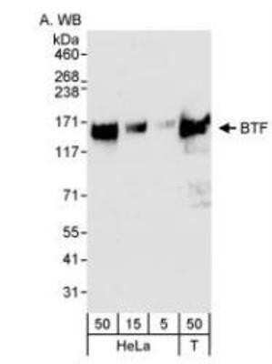 Western Blot: BTF Antibody [NB100-1704] - Whole cell lysate from HeLa (5, 15, 50 ug loaded) and 293T cells (T; 50 ug) probed with anti-BTF antibody at 0.04 ug/ml.