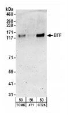 Western Blot: BTF Antibody [NB100-1704] - : Whole cell lysate (50 ug) from TCMK-1, 4T1, and CT26.WT cells.