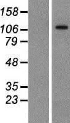 Western Blot: BTF Overexpression Lysate (Adult Normal) [NBP2-10307] Left-Empty vector transfected control cell lysate (HEK293 cell lysate); Right -Over-expression Lysate for BTF.