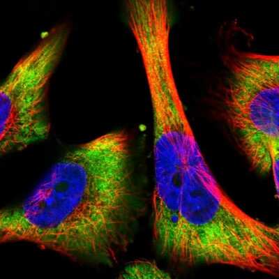 Immunocytochemistry/Immunofluorescence: BTF3 Antibody [NBP2-49225] - Immunofluorescent staining of human cell line U-251 MG shows localization to cytosol.