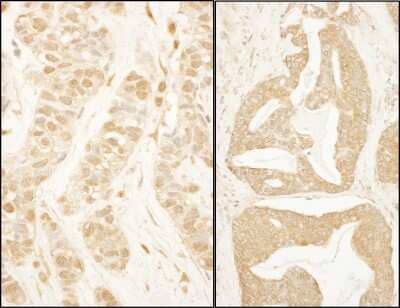 Immunohistochemistry BTF3 Antibody