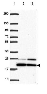 Western Blot BTF3 Antibody