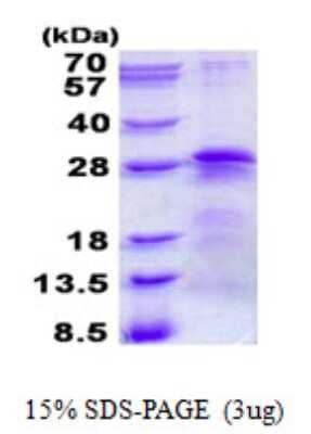 SDS-PAGE Recombinant Human BTF3 His Protein