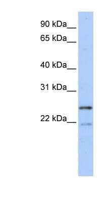 Western Blot: BTF3L3 Antibody [NBP1-70423] - Titration: 0.2-1 ug/ml, Positive Control: MCF7 cell lysate.