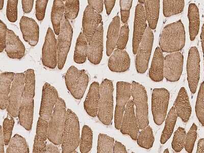 Immunohistochemistry-Paraffin: BTF3L4 Antibody [NBP2-98619] - Immunochemical staining of human BTF3L4 in human skeletal muscle with rabbit polyclonal antibody at 1:100 dilution, formalin-fixed paraffin embedded sections.
